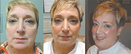 Terry Davis before (left) and after (middle). Far right: Terry enhanced her look with  a make up session by Sona for her upcoming daughter’s wedding.